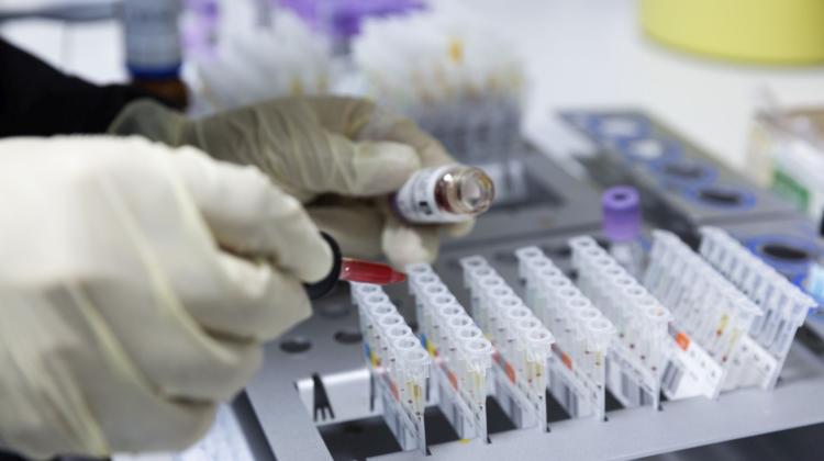 Эксперт: Зоонозные инфекции чаще всего бывают вирусными