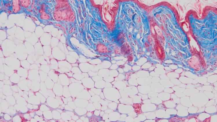 Исследование: Жировая ткань в пожилом возрасте способствует заживлению ран и улучшению внешнего вида кожи