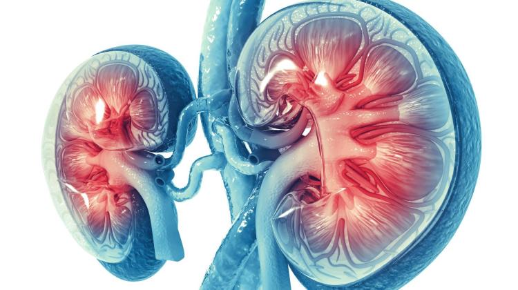 Эксперт: Заболевания почек и диализ требуют большей изоляции пациентов