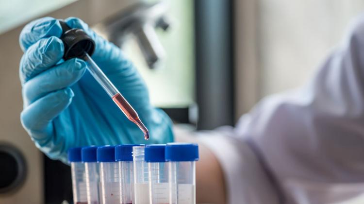 Проф. Томасевич: масштабы плазмотерапии зависят от количества доноров