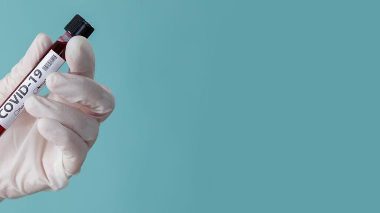 Проф. Саймон: мы не знаем, как будет развиваться эпидемия в Польше