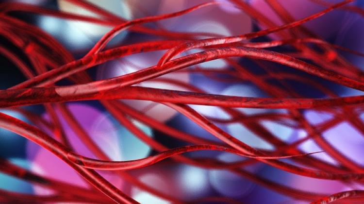 Проф. Палух: половина нашего общества страдает венозной недостаточностью