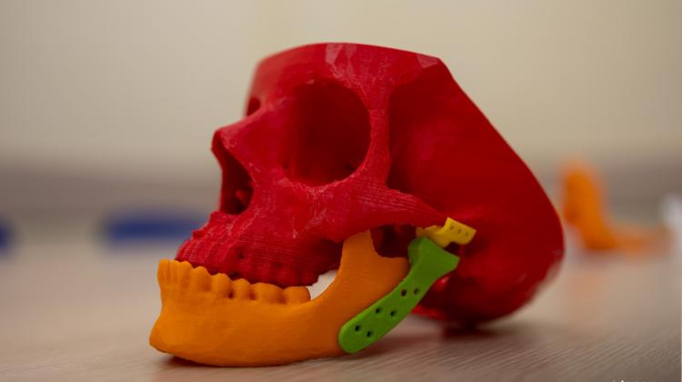 Ученые Белостокского политехнического университета работают над более прочным имплантатом височно-нижнечелюстного сустава