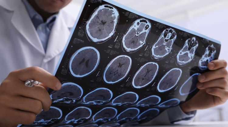 Еще один шаг к пониманию сложности педиатрических глиом