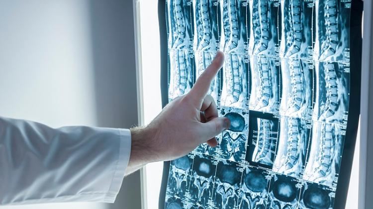 Доктор Ленгош: спрос на операции на позвоночнике растет