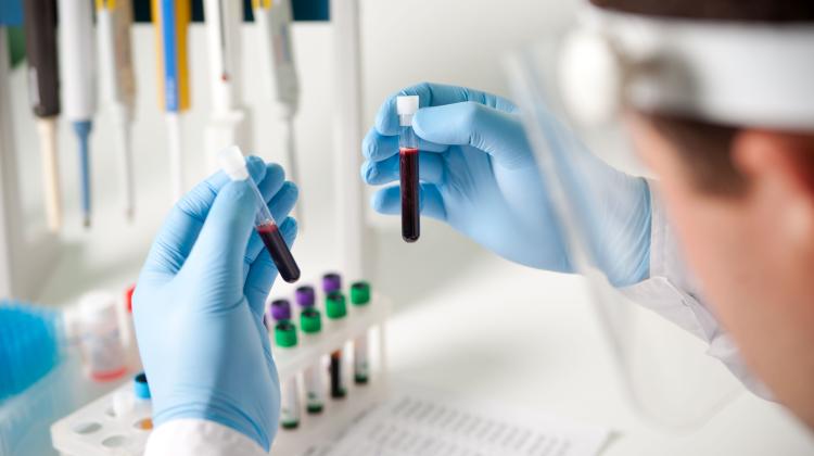 В Национальном институте кардиологии очистят кровь от плохого холестерина